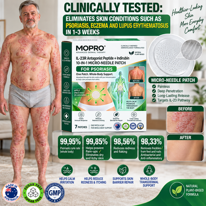 🔥 Only 10 left! Get 30% OFF your second purchase! MOPRO® helps reduce visible scaling, redness, dryness & itching while supporting psoriasis-prone skin. Limited stock — don’t miss out! 💚