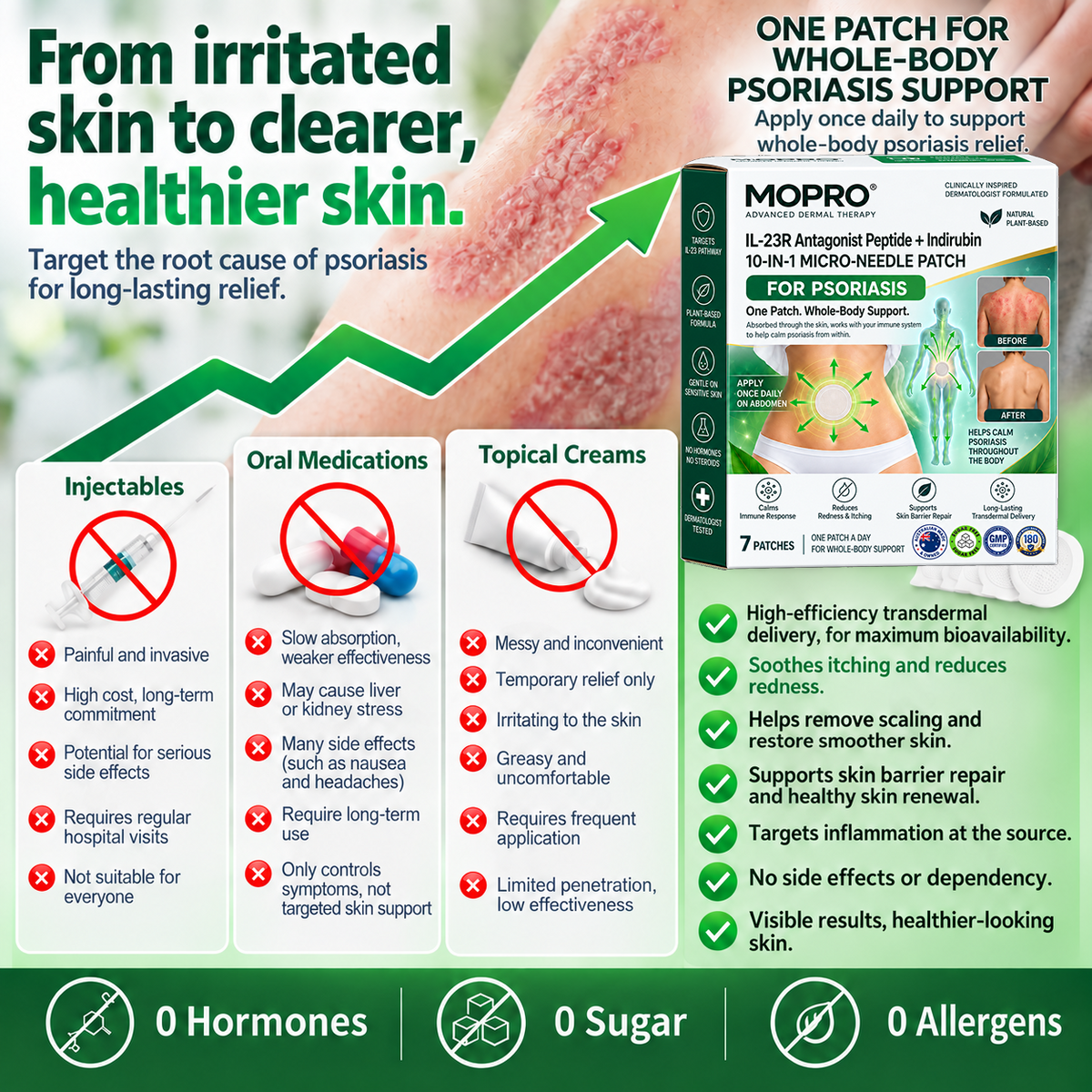 🔥 Only 10 left! Get 30% OFF your second purchase! MOPRO® helps reduce visible scaling, redness, dryness & itching while supporting psoriasis-prone skin. Limited stock — don’t miss out! 💚