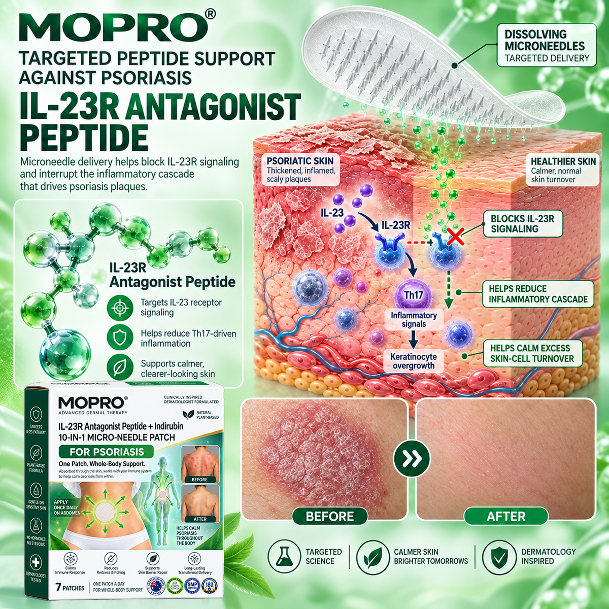 🔥 Only 10 left! Get 30% OFF your second purchase! MOPRO® helps reduce visible scaling, redness, dryness & itching while supporting psoriasis-prone skin. Limited stock — don’t miss out! 💚